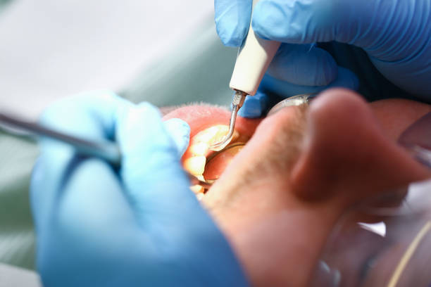 Best 24-Hour Emergency Dentist in Bald Kno, AR