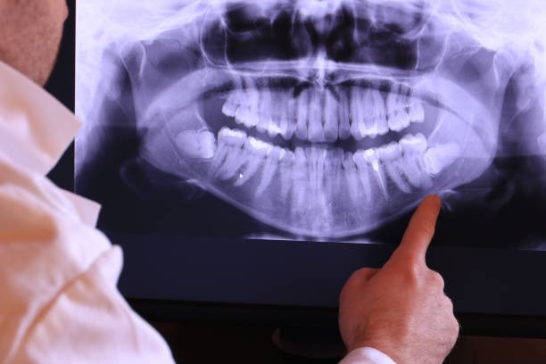 Best Broken or Cracked Tooth Emergency Dentist in Bald Kno, AR