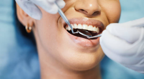 Best Emergency Dental Extractions in Bald Kno, AR