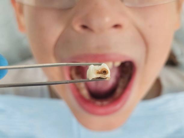 Best Weekend Emergency Dentist in Bald Kno, AR